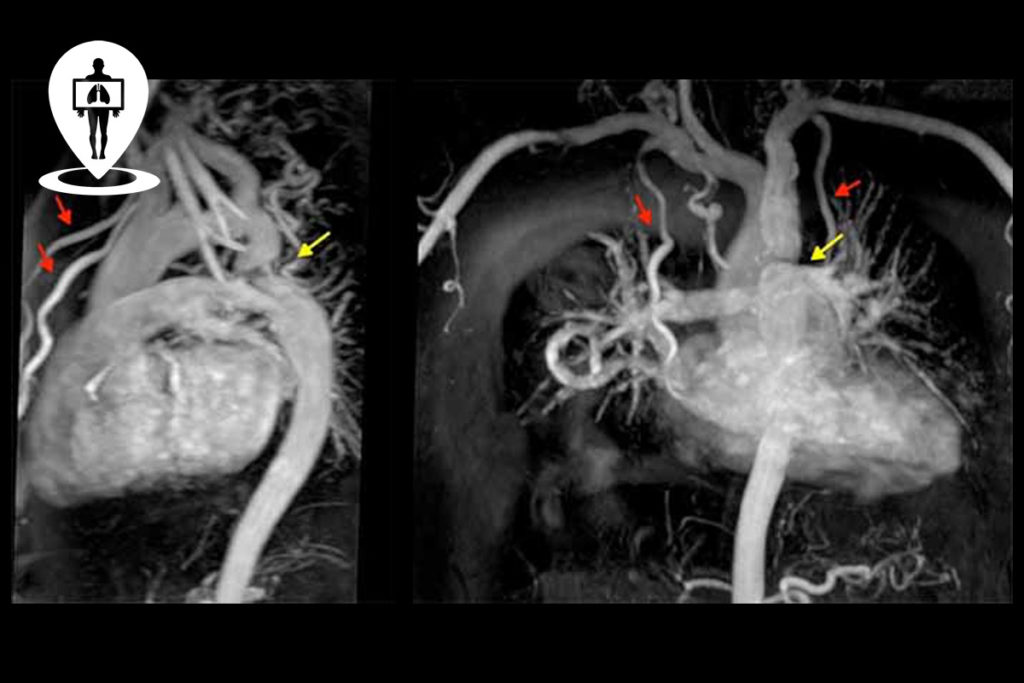 risonanza con contrasto Radiologia Italia