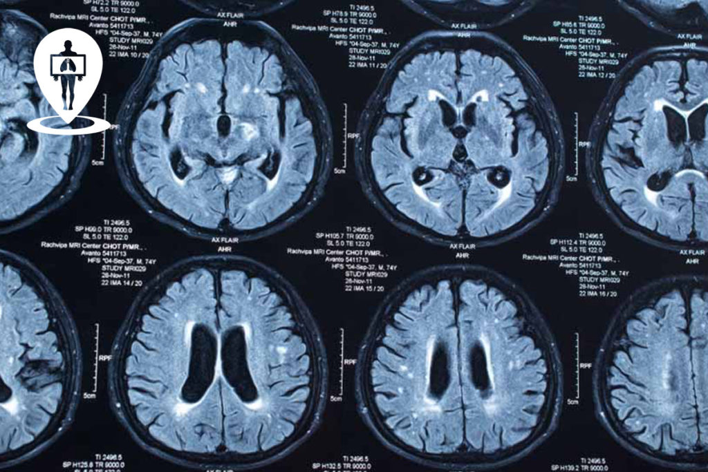 Tac Cos'è a Cosa Serve Radiologia Italia