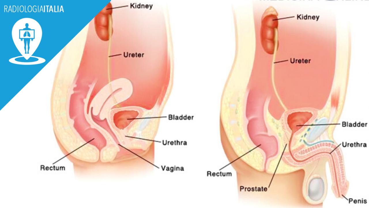 prostata organo cavo
